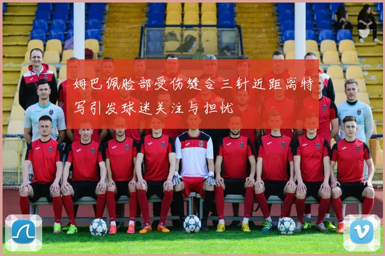 姆巴佩脸部受伤缝合三针近距离特写引发球迷关注与担忧